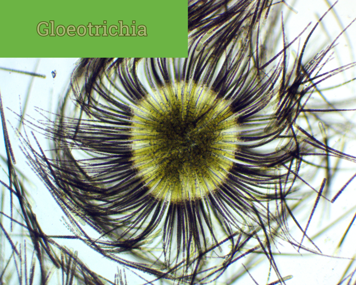 Gloeotrichia cyanobacteria is pollen-like by the naked eye, but appears to be a giant spiny anemone under a microscope