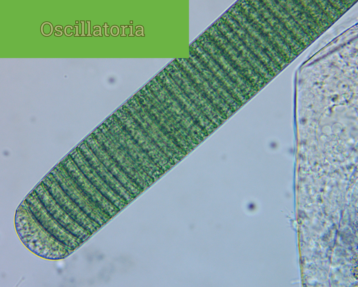Oscillatoria filament that is dark green with cells that look like stacks of buttons